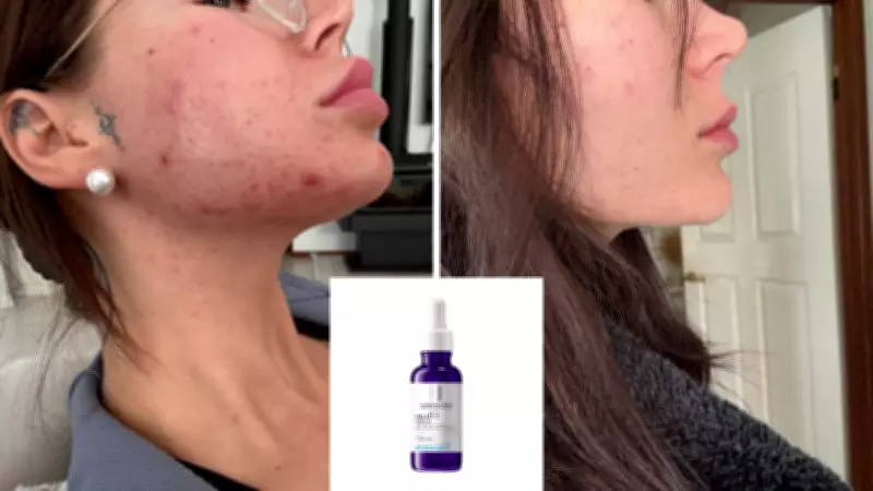 La Roche-Posay Mela B3 Serum Drops to $54.39 at Amazon Australia