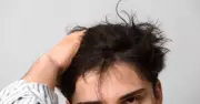 Hair Transplant in Turkey: What Australians Should Know Before Booking