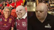 Man with rare skin condition targeted by trolls and AI bot