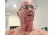 SA Defence Leader Left Bleeding After Roo Altercation