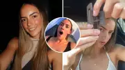 TikTok Star Warns After Broken Hair Clip Shoots Metal Into Her Leg