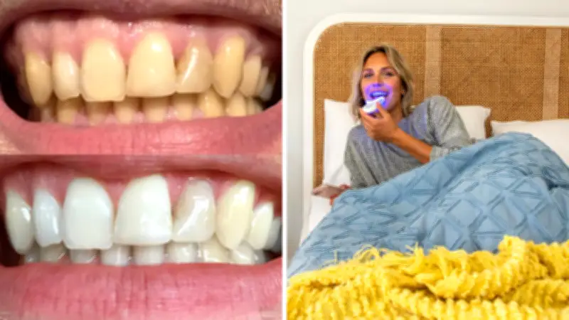 Aussies Save Big with SmilePro's 60% Off Teeth Whitening Kit