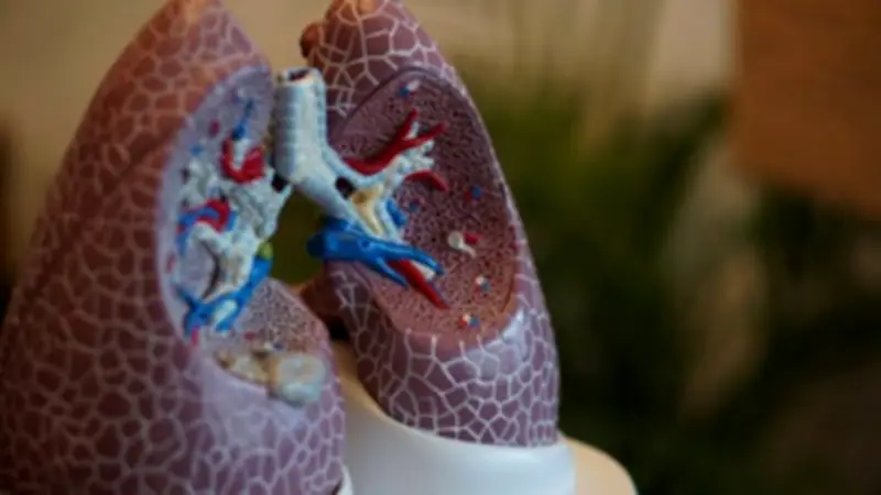 Australia's Lung Cancer Screening Program: A Year On, Health System Challenges Remain