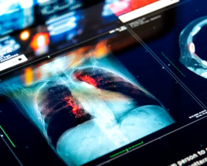 Doctors and NHS Could Be Sued for AI Mistakes, Report Warns