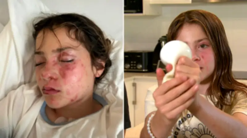 Girl Suffers Burns from Microwaved Squishy Toy Trend