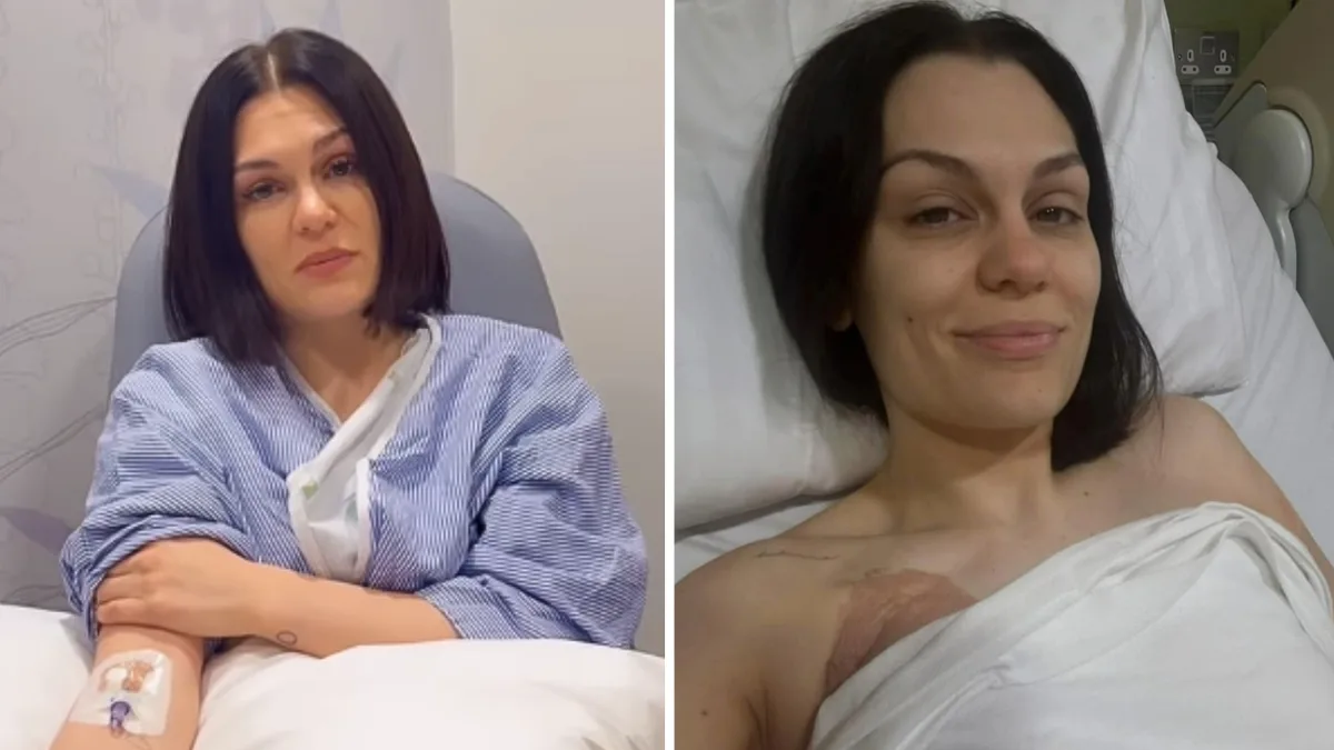 Jessie J Announces She Is Cancer-Free After Breast Cancer Battle