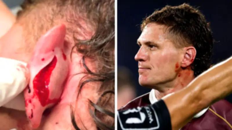 Kalyn Ponga's Gruesome Ear Injury Reveals Truth Behind Origin Incident
