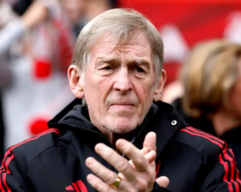 Liverpool Legend Sir Kenny Dalglish, 75, Reveals Cancer Treatment