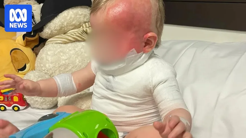 Mother of Baby Burned in Coffee Attack Pleads for Justice as Suspect Fled to China