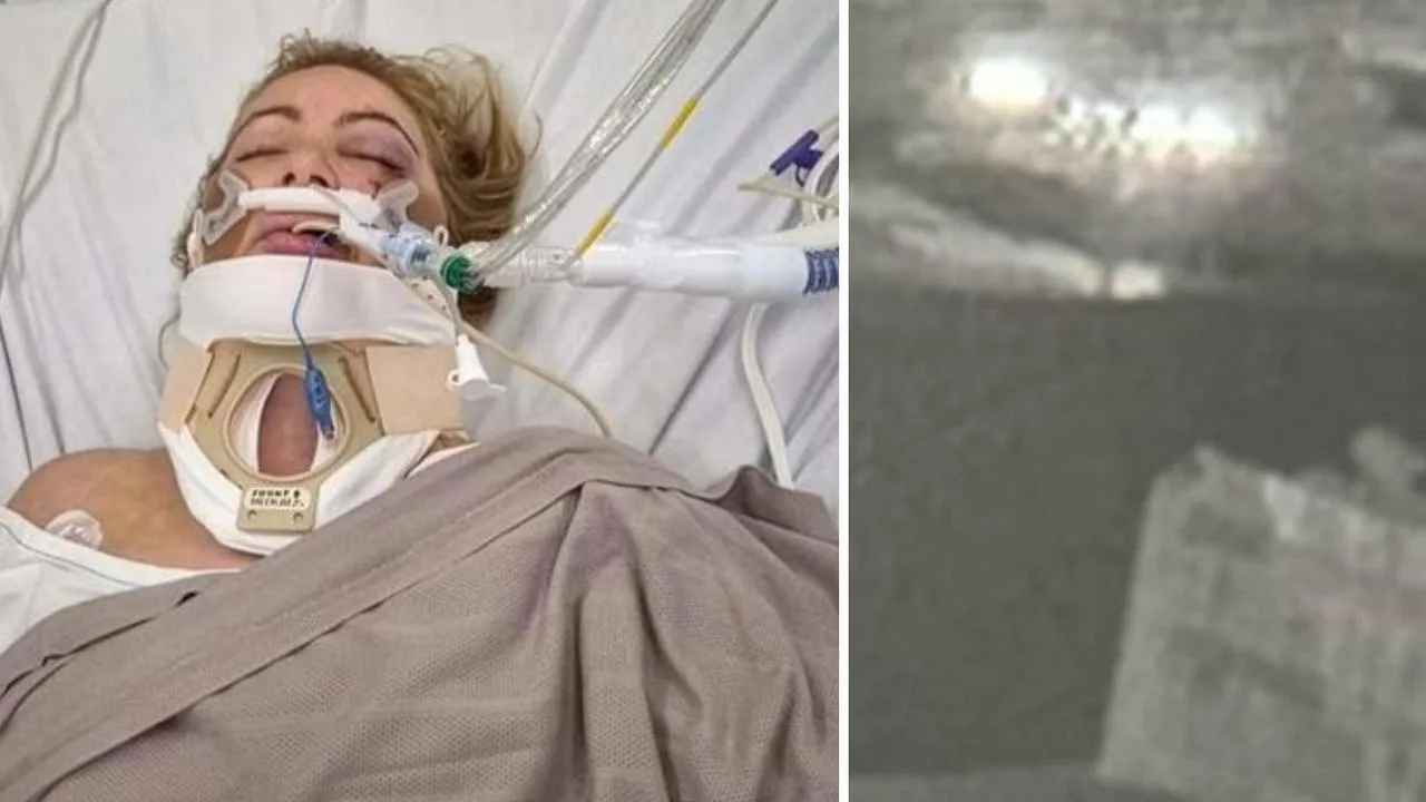 Mother of Five in Coma After Hit-and-Run E-Scooter Crash