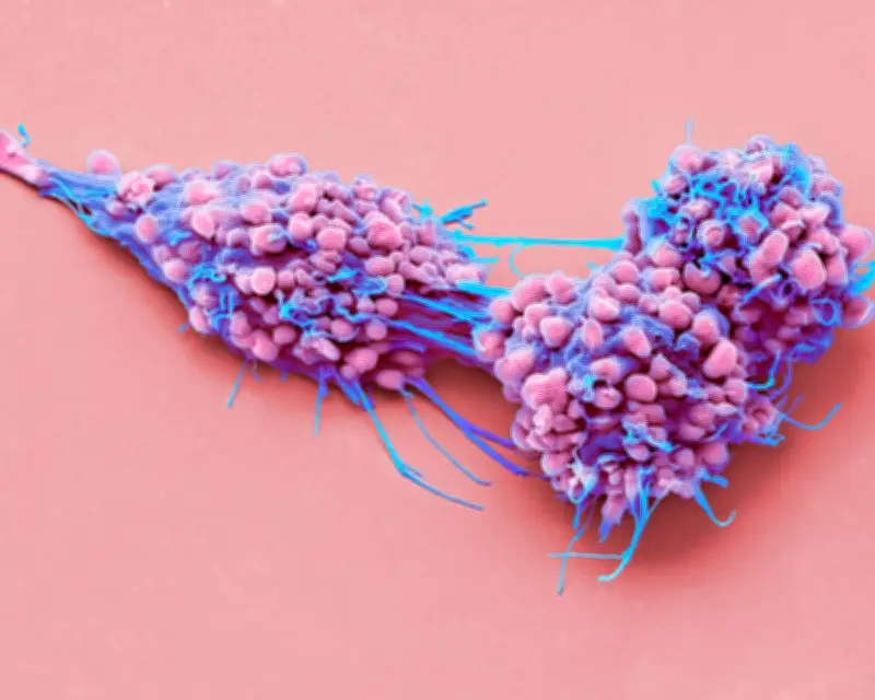 New ovarian cancer drug Elahere approved for NHS use in England