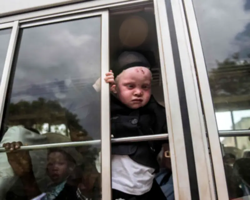 Nigerian Woman with Albinism Denied US Asylum After Uganda Refuge