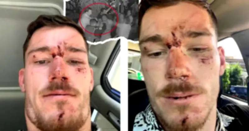 Raiders Star Tom Starling Opens Up on Police Assault Ordeal as Officers Face Charges