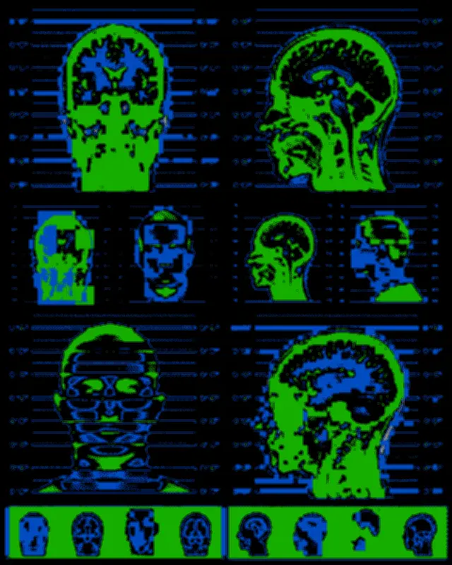 Scientist Challenges US Legal System Over Brain Violence Link
