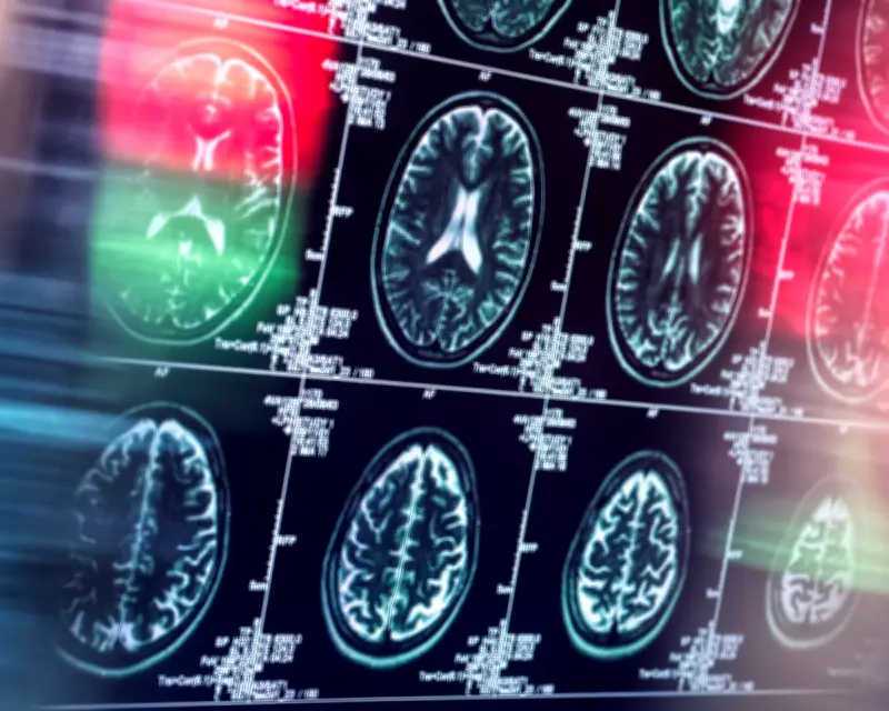 Study Finds Non-Opioid Painkillers Equally Effective for Many Conditions