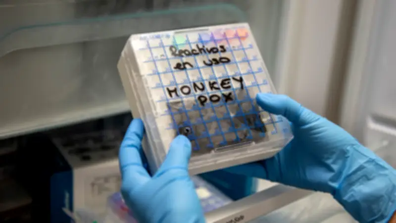 US Scientists Charged for Smuggling Mpox Vials from Africa