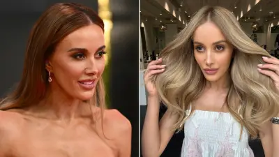 Bec Judd Reveals Botox Mishap Left Her Looking Like an Alien