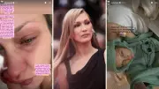 Bella Hadid Opens Up About Severe Lyme Disease Flare-Up, Struggles with Joy