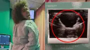 Casey Donovan Reveals Major IVF Milestone with Fiancée Renee Sharples