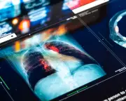 Doctors and NHS Could Be Sued for AI Mistakes, Report Warns
