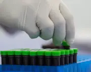 Mpox Spread Sparks Congressional Scrutiny of NIH Response