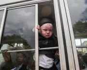 Nigerian Woman with Albinism Denied US Asylum After Uganda Refuge