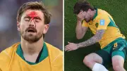 Socceroos Star Connor Metcalfe Bloodied in World Cup Clash Against Paraguay