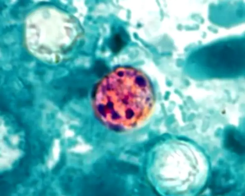 US Cyclosporiasis Cases Surge: Michigan Reports 700 Parasitic Illnesses