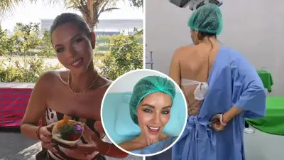 MAFS Star Bec Zacharia Among Influencers Who Underwent Rib Surgery in Bali